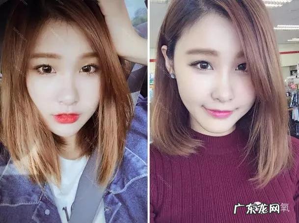 张馨予鼻子是谁做的 张馨予隆鼻