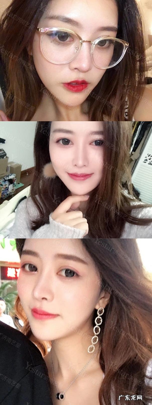 明星都怎么隆鼻 明星隆鼻为什么没有疤痕