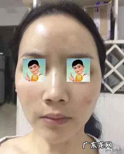 张沫凡小姐姐的鼻子整容过程 网红怎么p鼻子