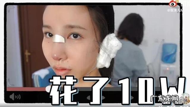 张沫凡小姐姐的鼻子整容过程 网红怎么p鼻子