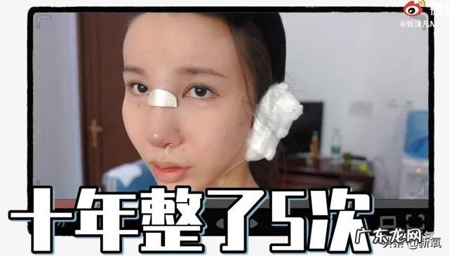 张沫凡小姐姐的鼻子整容过程 网红怎么p鼻子
