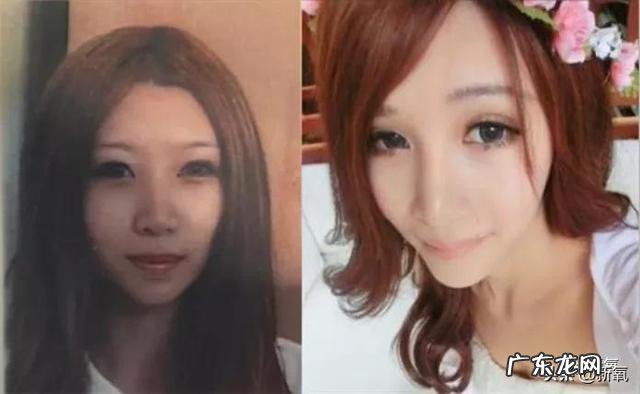 张沫凡小姐姐的鼻子整容过程 网红怎么p鼻子