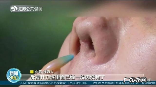 隆鼻后鼻梁处有凹陷是怎么回事 女主播隆鼻手术后鼻子凹陷