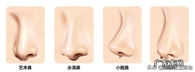 耳软骨隆鼻多久后自然 耳软骨隆鼻鼻尖多久吸收得自然