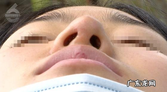 昆明哪家隆鼻术好 昆明隆鼻哪家比较好