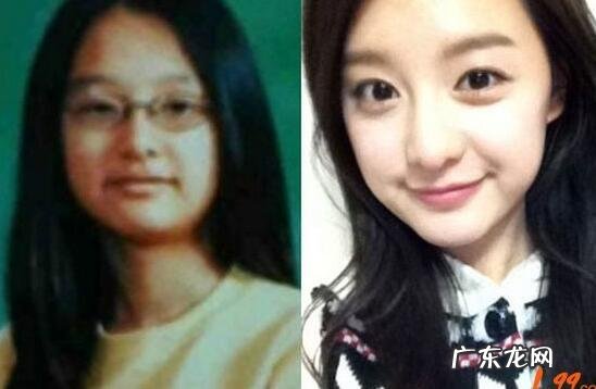 《太阳的后裔》金智媛个人资料被扒 整容前后对比照曝光吓死人