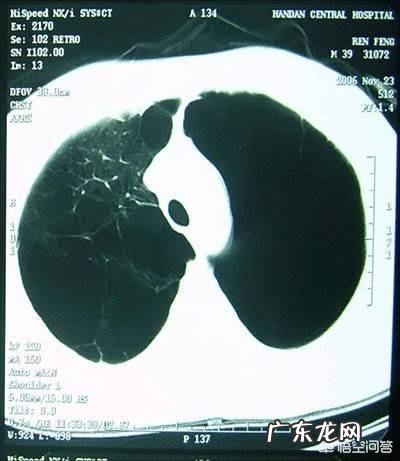 慢性阻塞性肺疾病,您了解吗?