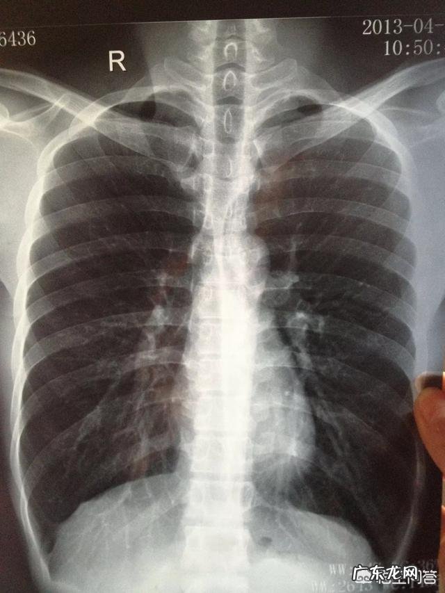 慢性阻塞性肺疾病,您了解吗?