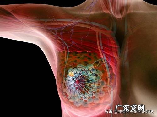 乳房有肿块,没有觉到异样,什么情况