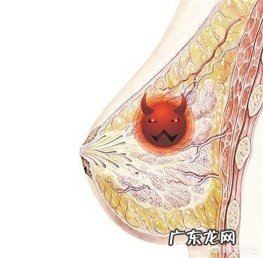 乳房有肿块,没有觉到异样,什么情况