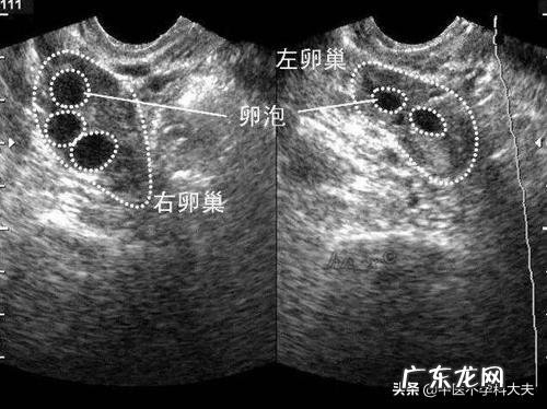 性激素六项雌二醇低,是不是预示当月卵泡质量不会好?
