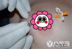 张天爱乳环事件回顾 张天爱乳环照曝光