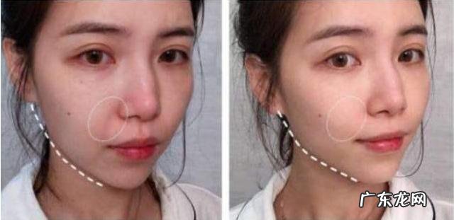 使用同款护肤品,皮肤却没有别人好,以下4条症状说明毛孔堵塞了