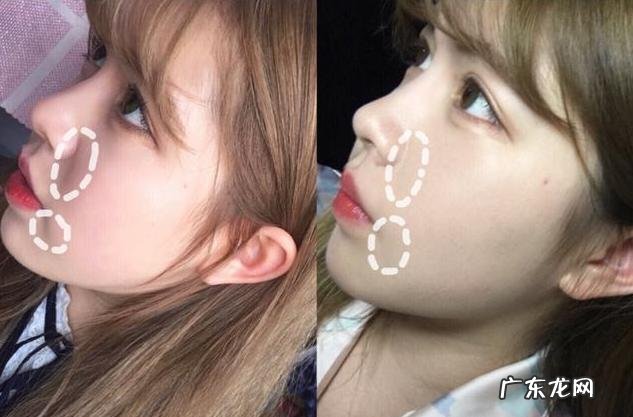 使用同款护肤品,皮肤却没有别人好,以下4条症状说明毛孔堵塞了