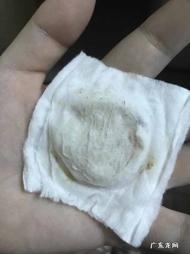 使用同款护肤品,皮肤却没有别人好,以下4条症状说明毛孔堵塞了