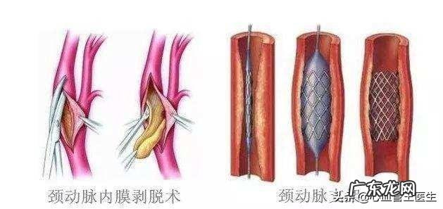 肿瘤标志物升高是癌症吗？