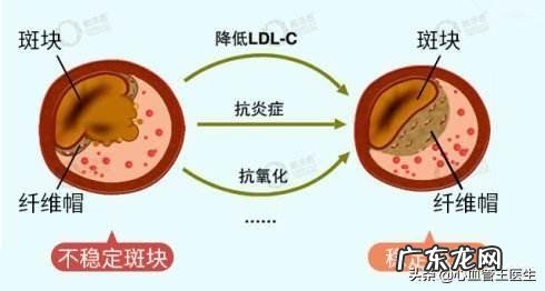 肿瘤标志物升高是癌症吗?