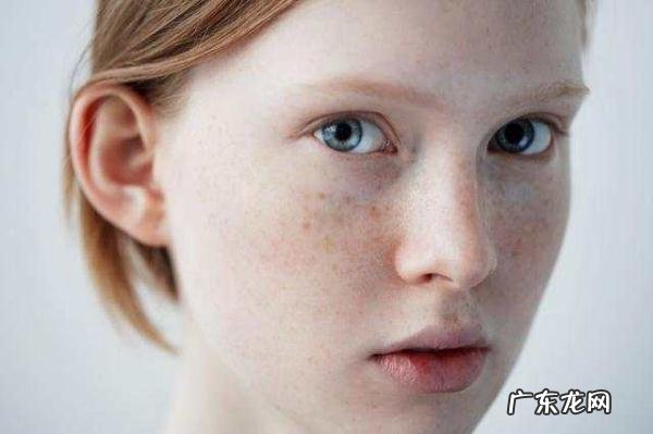 淡斑祛黑色素用什么 如何淡斑祛黑色素