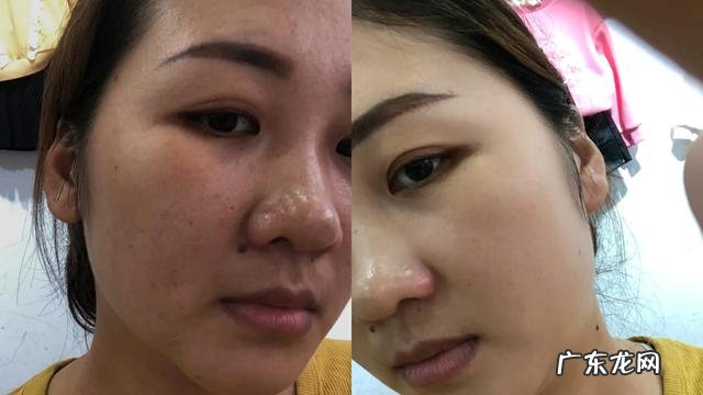 皮肤美白最快的小妙招 皮肤美白最快最有效的方法