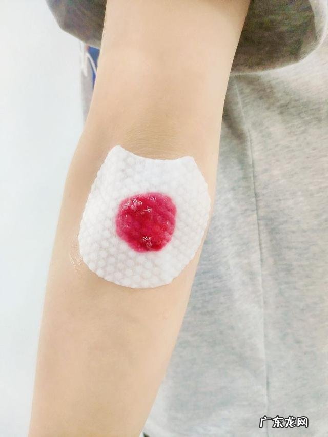 刷酸的美白产品 刷酸美白效果怎么样