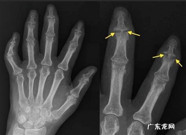 3岁小孩总喜欢挖鼻孔、揉眼睛、含手指，是什么原因