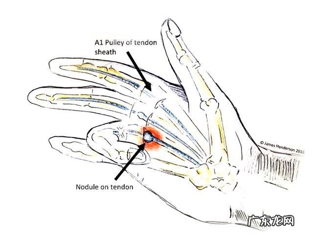 3岁小孩总喜欢挖鼻孔、揉眼睛、含手指，是什么原因