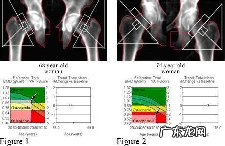 3岁小孩总喜欢挖鼻孔、揉眼睛、含手指，是什么原因