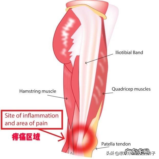几个月前因为运动过度,导致膝关节疼痛,为什么不跑就不会疼了