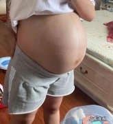 剖腹产术后用的“镇痛棒”有哪些副作用，所有产妇一定要用吗？