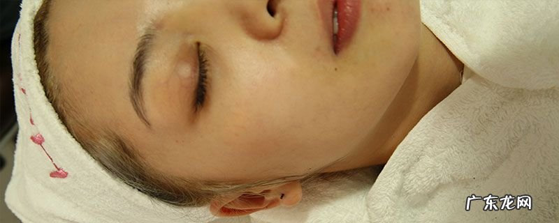 激素脸恢复分几个阶段