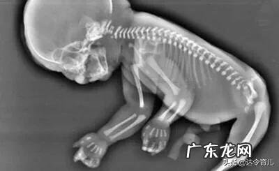 孕妇怀孕8个月,补什么有利于宝宝骨骼增长?