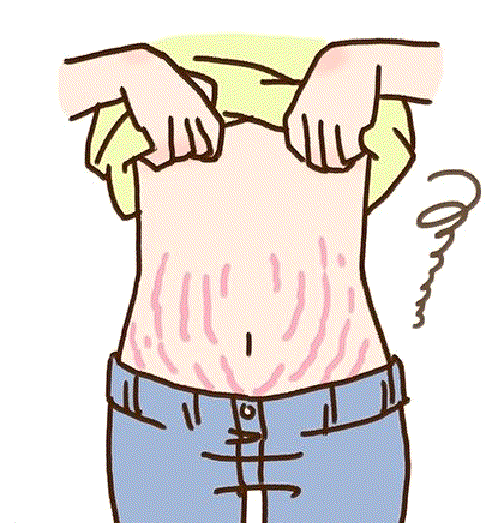 女人胳膊瘦了皮肤松弛怎么办? 50岁胳膊皮肤松弛怎么办