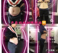 剖腹产后身材松松垮垮，体重180斤，怎样短时间掉秤50斤