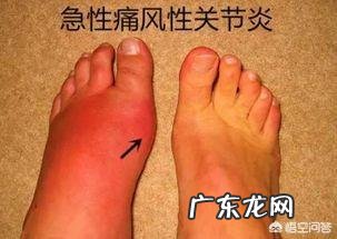 比较懒不爱运动的人,吃蛋白粉能减肥吗?