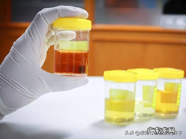 老年人身体突然消瘦去医院体检应该检查哪几项?