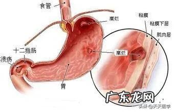 糜烂性胃炎吃肉和醋有影响吗?