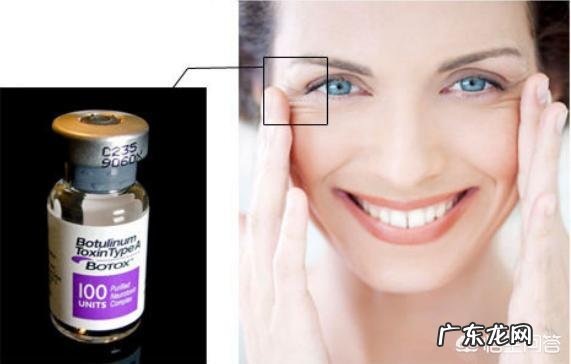 打完除皱针脸部要多久可以恢复自然呢？