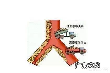 人到多大年龄,动脉会开始长斑块并出现硬化的现象