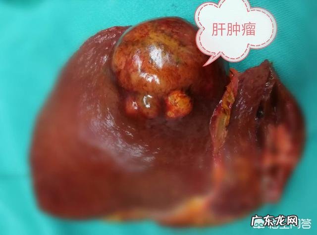 正常健康的人可以选择哪些基因检测呢