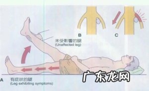 80%的腰椎间盘突出症,靠这4种方法能缓解