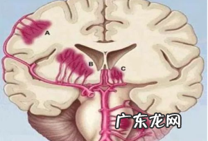 脑出血有何症状?脑出血该如何预防?
