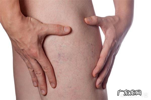 小腿的皮肤发痒,该怎么止痒?有什么好方法?