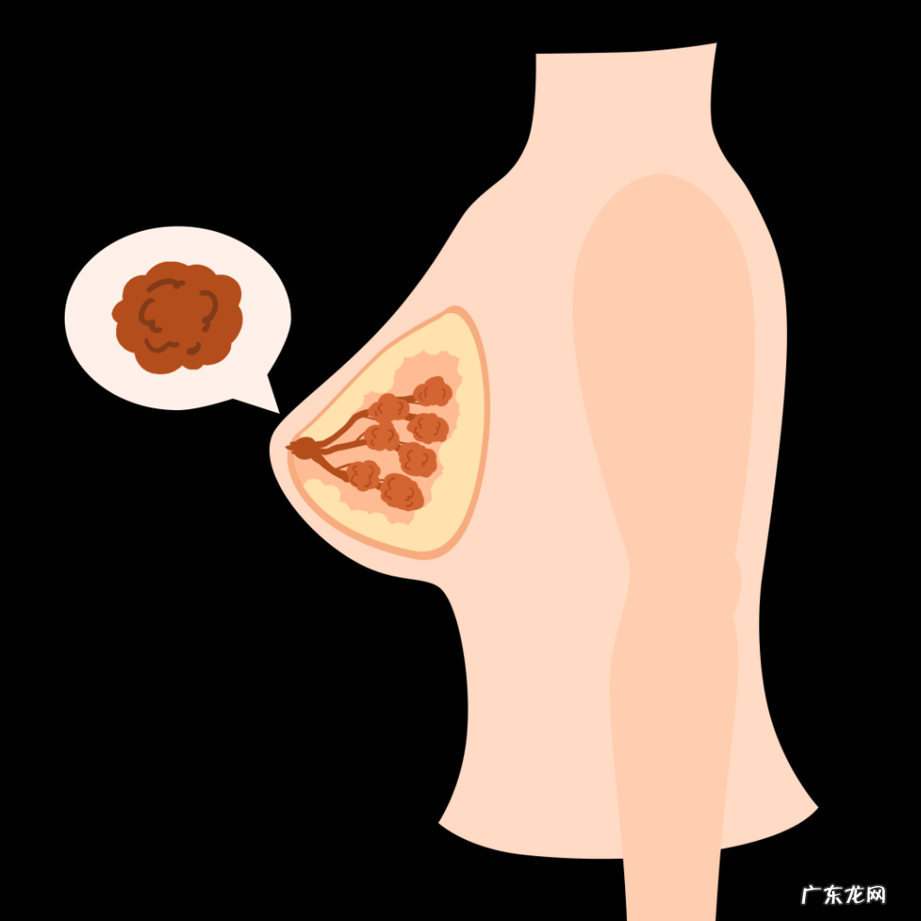 关爱女性健康,女性常见疾病与预防
