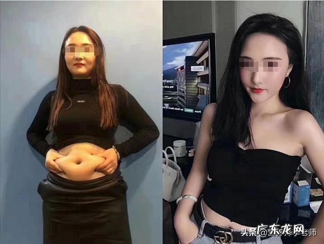 女生,150CM的个子,体重102斤,减肥多少好呢?