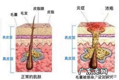 请问去美容店洗脸一个月洗几次才好呢?