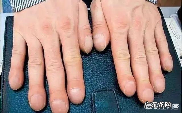 医生说:肺好不好,不用去医院,3招在家可“自查”,具体指什么