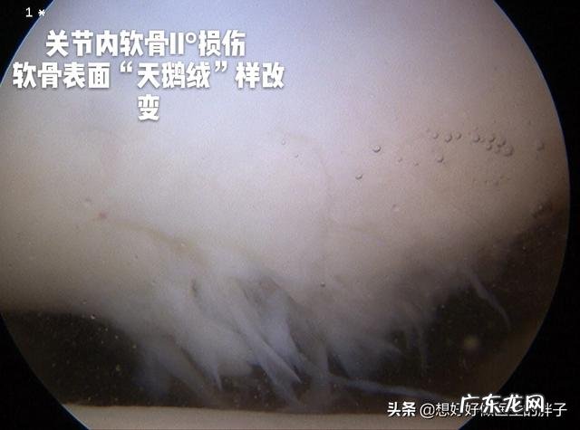 老年人如何才能避免肌肉过快流失?如何才能健康的老去呢?