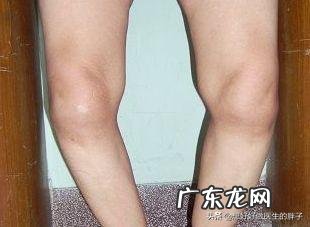 老年人如何才能避免肌肉过快流失?如何才能健康的老去呢?