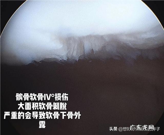 老年人如何才能避免肌肉过快流失?如何才能健康的老去呢?