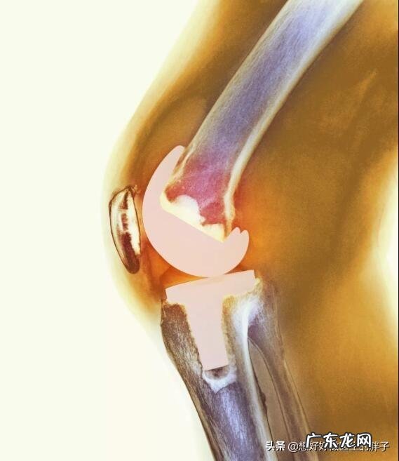 体寒的人冷暖交替膝盖疼该怎么办